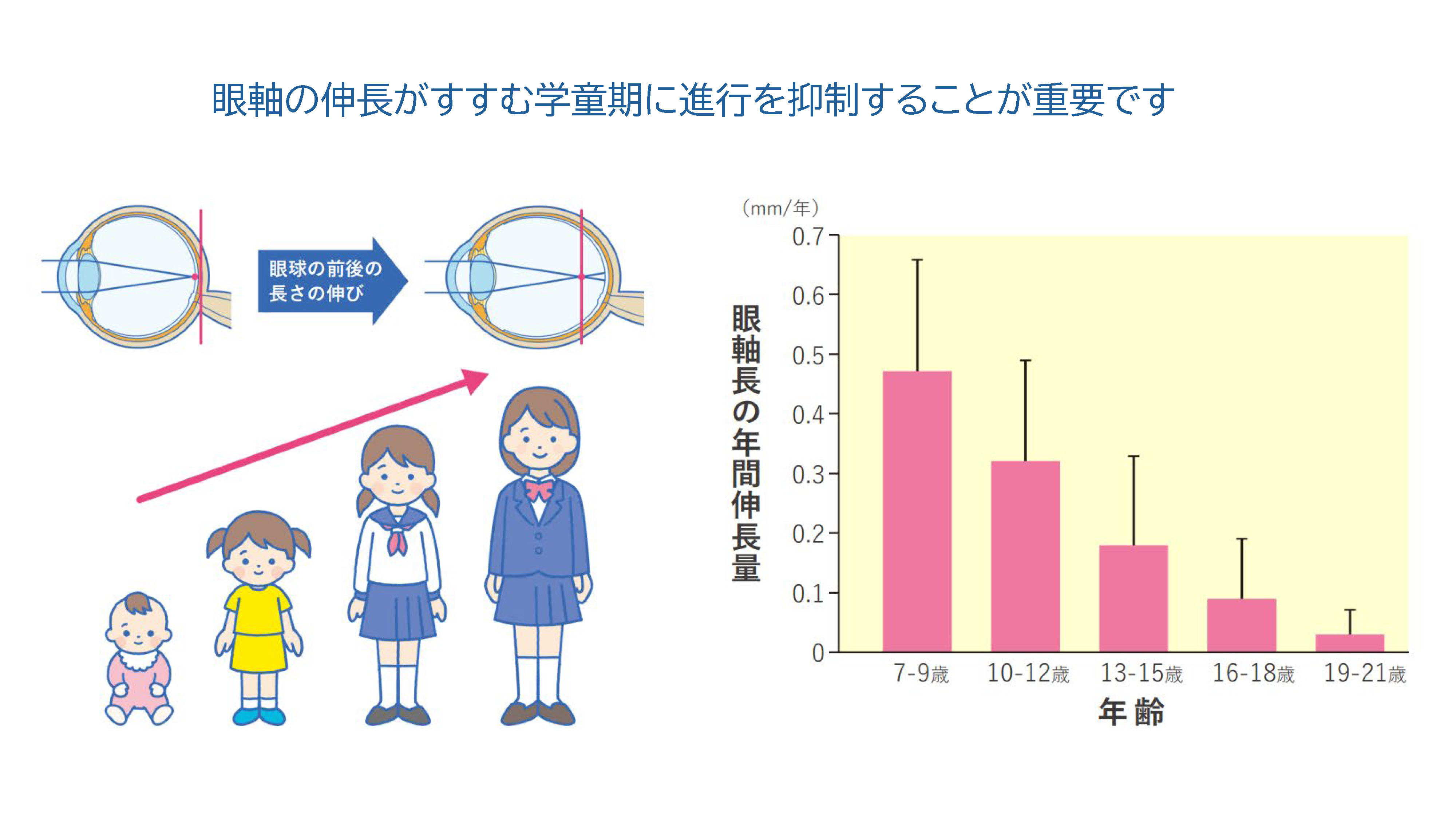 近視抑制点眼薬「リジュセアミニ」
